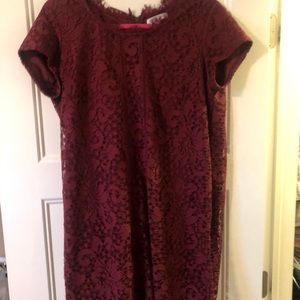 Beautiful lace detail dress